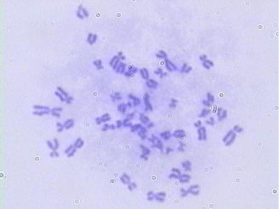 replikacja chromosomów